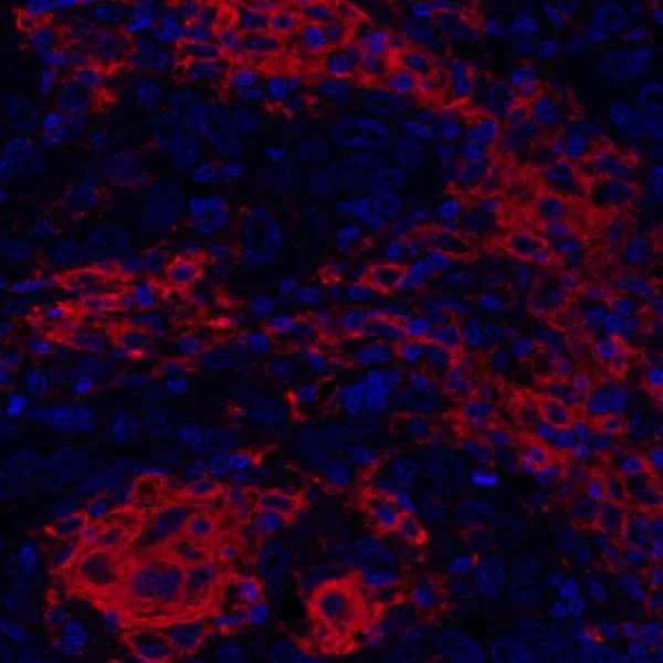Immunohistochemistry (Formalin/PFA-fixed paraffin-embedded sections) - Anti-CD40 antibody [BLR056F] (AB252557)