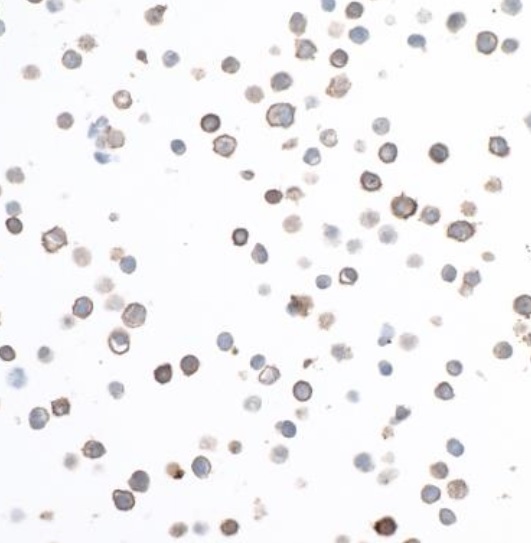 Immunocytochemistry - Anti-CD40 antibody [BLR056F] - BSA free (AB272087), expandable thumbnail