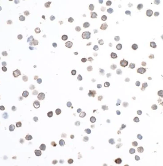 Immunocytochemistry - Anti-CD40 antibody [BLR056F] - BSA free (AB272087)