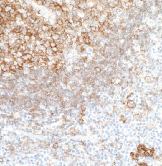Immunohistochemistry (Formalin/PFA-fixed paraffin-embedded sections) - Anti-CD40 antibody [BLR056F] - BSA free (AB272087)