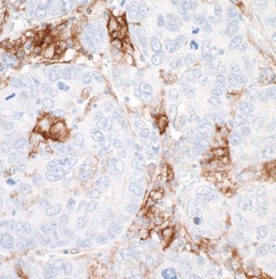 Immunohistochemistry (Formalin/PFA-fixed paraffin-embedded sections) - Anti-CD40 antibody [BLR056F] - BSA free (AB272087), expandable thumbnail