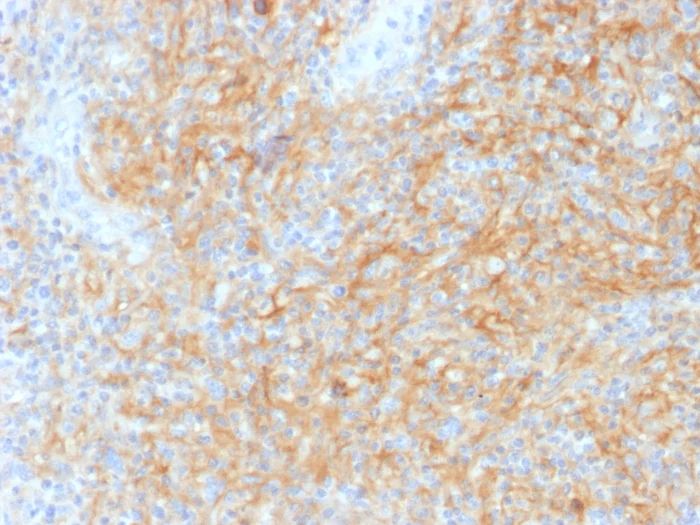 Immunohistochemistry (Formalin/PFA-fixed paraffin-embedded sections) - Anti-CD40 antibody [C40/1605] (AB217900)