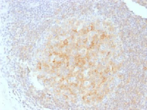 Immunohistochemistry (Formalin/PFA-fixed paraffin-embedded sections) - Anti-CD40 antibody [C40/1605] (AB217900)