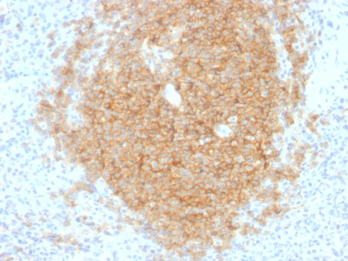 Immunohistochemistry (Formalin/PFA-fixed paraffin-embedded sections) - Anti-CD40 antibody [C40/1605] (AB217900)