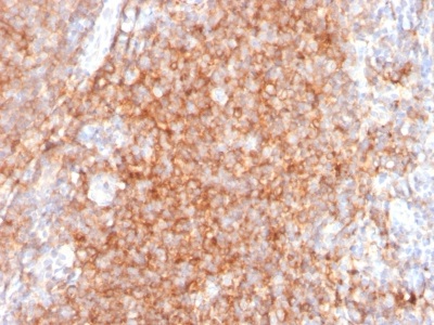 Immunohistochemistry (Formalin/PFA-fixed paraffin-embedded sections) - Anti-CD40 antibody [C40/2383] - BSA and Azide free (AB237947), expandable thumbnail