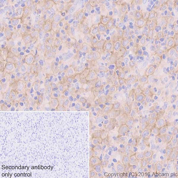 Immunohistochemistry (Formalin/PFA-fixed paraffin-embedded sections) - Anti-CD40 antibody [EPR20540] - BSA and Azide free (AB271995), expandable thumbnail