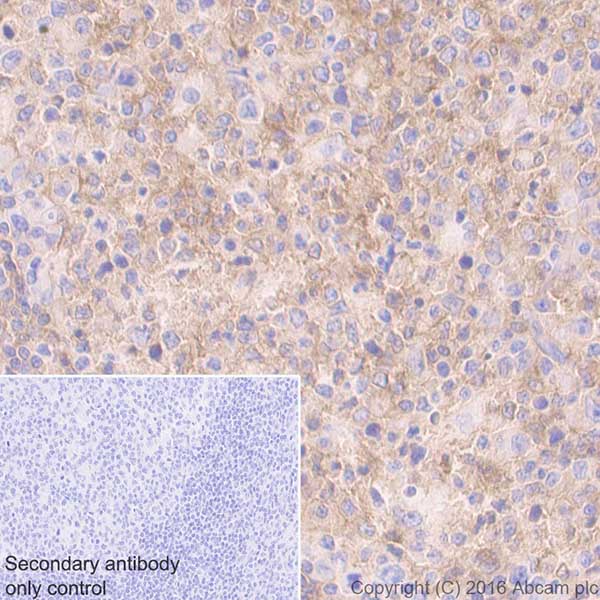 Immunohistochemistry (Formalin/PFA-fixed paraffin-embedded sections) - Anti-CD40 antibody [EPR20540] - BSA and Azide free (AB271995), expandable thumbnail