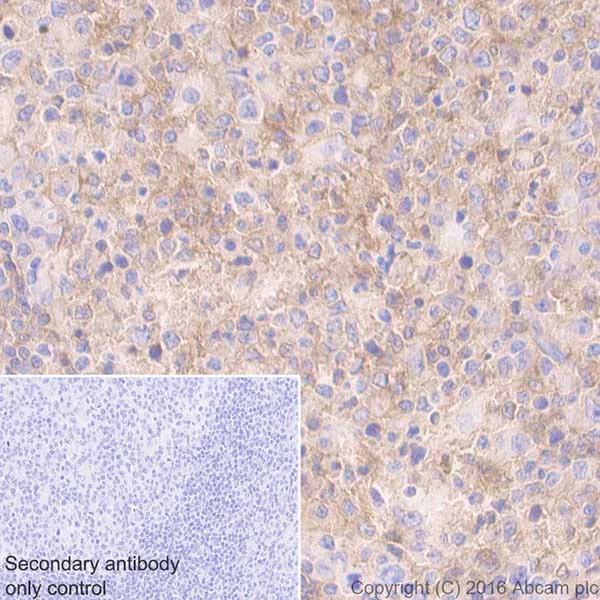 Immunohistochemistry (Formalin/PFA-fixed paraffin-embedded sections) - Anti-CD40 antibody [EPR20540] - BSA and Azide free (AB271995)