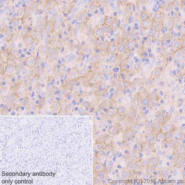 Immunohistochemistry (Formalin/PFA-fixed paraffin-embedded sections) - Anti-CD40 antibody [EPR20540] - Low endotoxin, Azide free (AB223546)