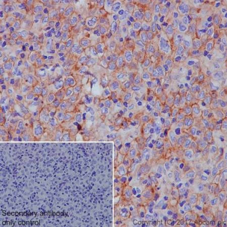 Immunohistochemistry (Formalin/PFA-fixed paraffin-embedded sections) - Anti-CD40 antibody [EPR20735] - BSA and Azide free (ab228818), expandable thumbnail