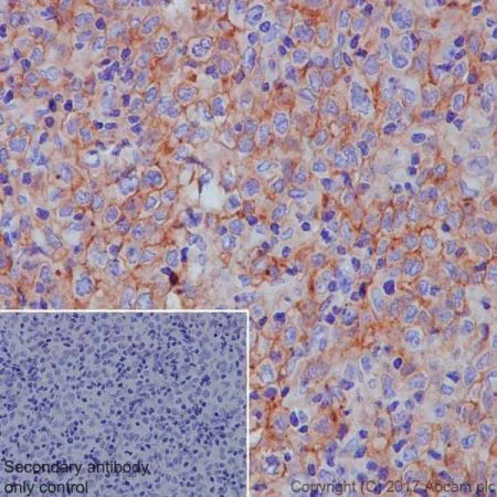 Immunohistochemistry (Formalin/PFA-fixed paraffin-embedded sections) - Anti-CD40 antibody [EPR20735] - BSA and Azide free (AB228818)