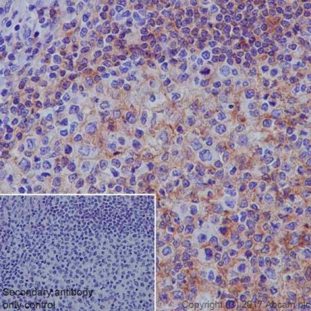 Immunohistochemistry (Formalin/PFA-fixed paraffin-embedded sections) - Anti-CD40 antibody [EPR20735] - BSA and Azide free (AB228818), expandable thumbnail