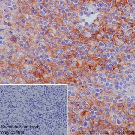 Immunohistochemistry (Formalin/PFA-fixed paraffin-embedded sections) - Anti-CD40 antibody [EPR20735] - BSA and Azide free (ab228818), expandable thumbnail