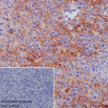 Immunohistochemistry (Formalin/PFA-fixed paraffin-embedded sections) - Anti-CD40 antibody [EPR20735] - BSA and Azide free (AB228818)