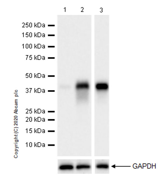 Western blot - Anti-CD40 antibody [EPR23890-151] (AB252428), expandable thumbnail