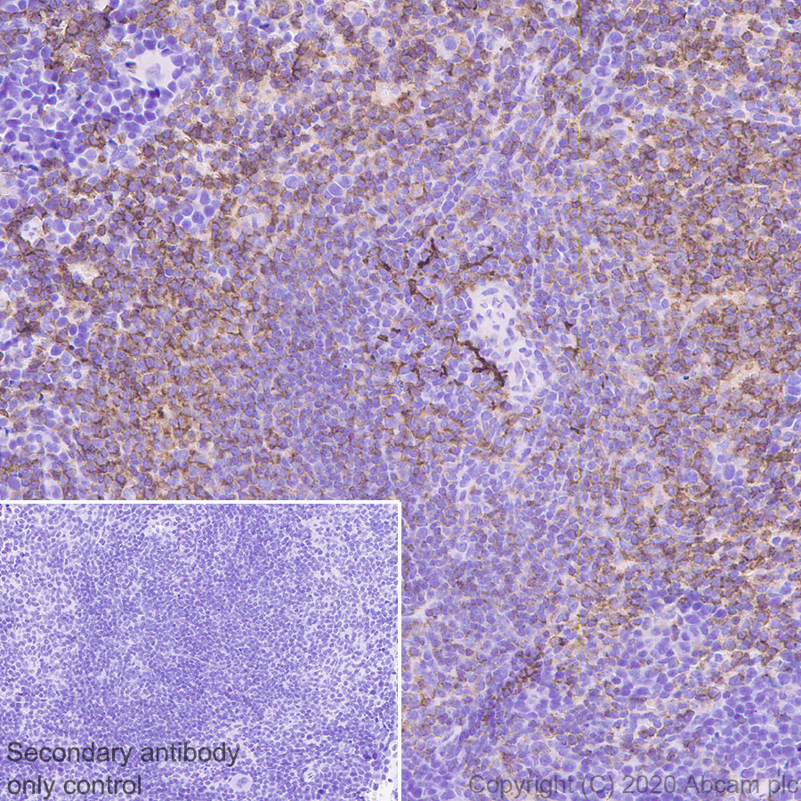 Immunohistochemistry (Formalin/PFA-fixed paraffin-embedded sections) - Anti-CD40 antibody [EPR23890-151] - BSA and Azide free (AB273098), expandable thumbnail