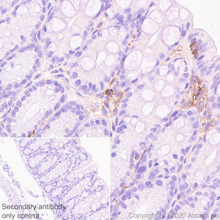 Immunohistochemistry (Formalin/PFA-fixed paraffin-embedded sections) - Anti-CD40 antibody [EPR23890-151] - BSA and Azide free (AB273098)
