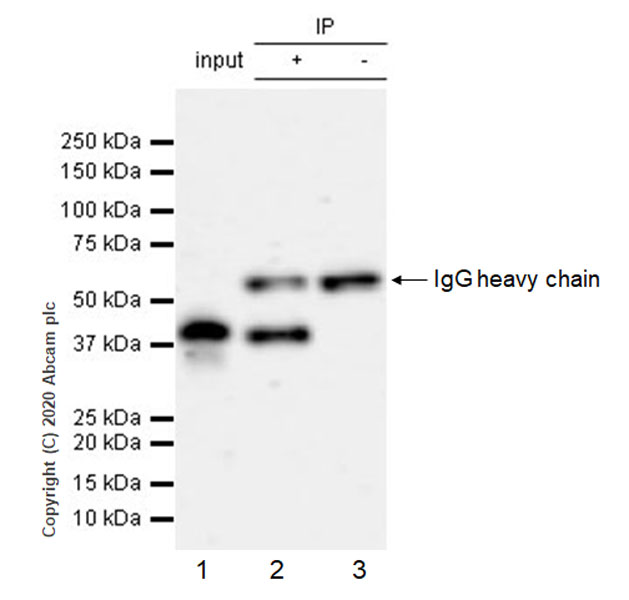 Immunoprecipitation - Anti-CD40 antibody [EPR23890-151] - BSA and Azide free (AB273098), expandable thumbnail