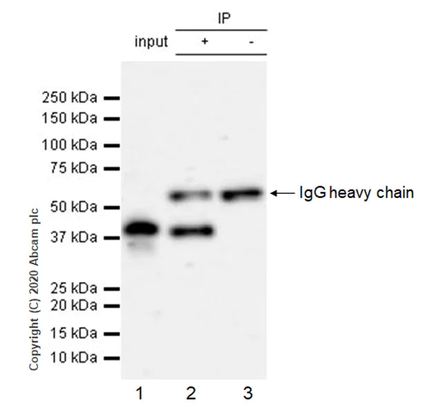 Immunoprecipitation - Anti-CD40 antibody [EPR23890-151] - BSA and Azide free (AB273098)