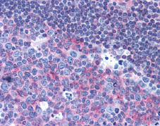 Immunohistochemistry (Formalin/PFA-fixed paraffin-embedded sections) - Anti-CD40 antibody [HB14] (AB79518), expandable thumbnail
