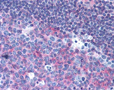 Immunohistochemistry (Formalin/PFA-fixed paraffin-embedded sections) - Anti-CD40 antibody [HB14] (AB79518)