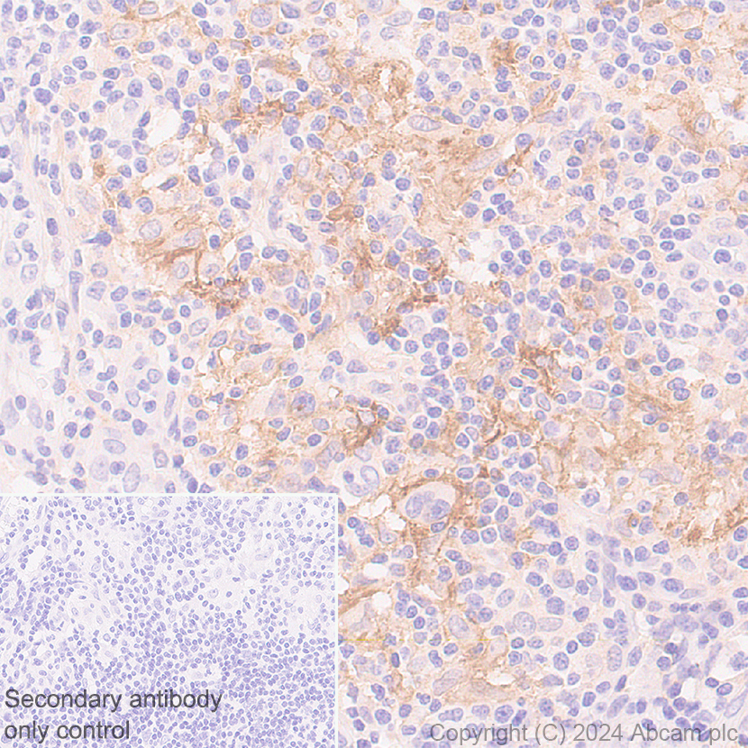 Immunohistochemistry (Formalin/PFA-fixed paraffin-embedded sections) - Anti-CD40 antibody [RM1193] (ab317586), expandable thumbnail