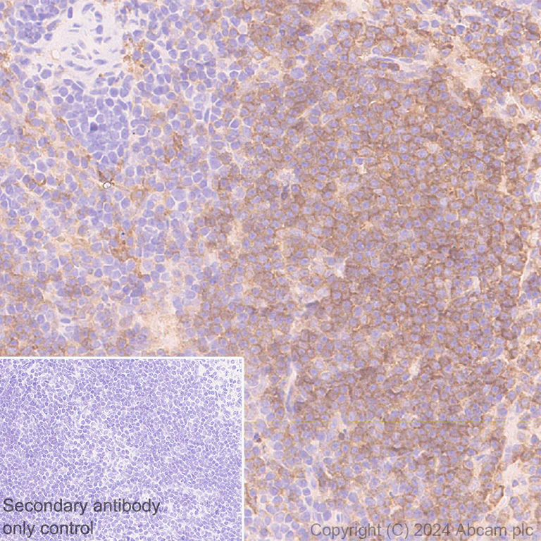 Immunohistochemistry (Formalin/PFA-fixed paraffin-embedded sections) - Anti-CD40 antibody [RM1193] (AB317586)
