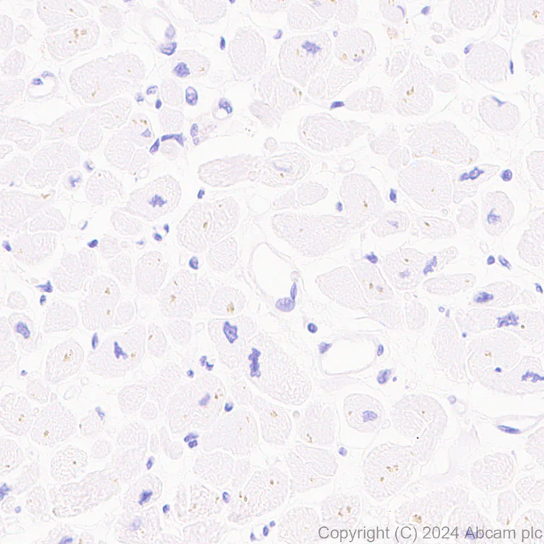 Immunohistochemistry (Formalin/PFA-fixed paraffin-embedded sections) - Anti-CD40 antibody [RM1193] (AB317586)