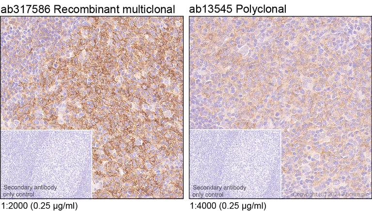 Immunohistochemistry (Formalin/PFA-fixed paraffin-embedded sections) - Anti-CD40 antibody [RM1193] - BSA and Azide free (AB317587)