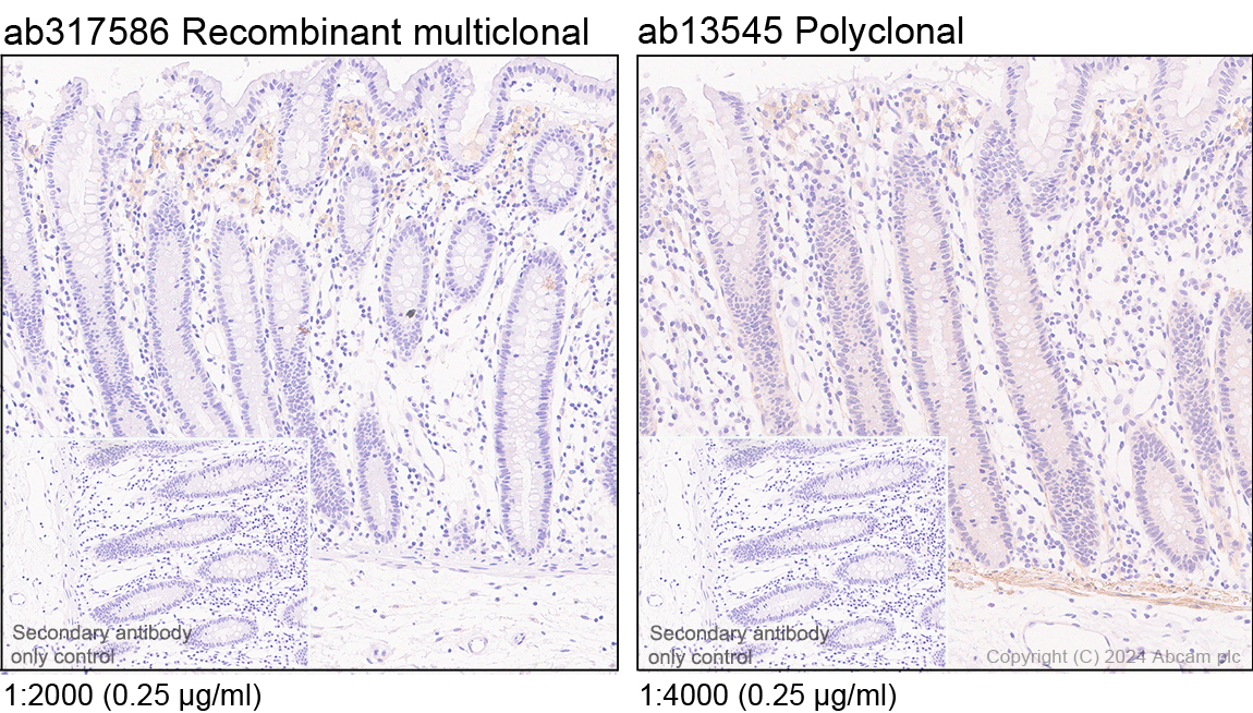 Immunohistochemistry (Formalin/PFA-fixed paraffin-embedded sections) - Anti-CD40 antibody [RM1193] - BSA and Azide free (ab317587), expandable thumbnail