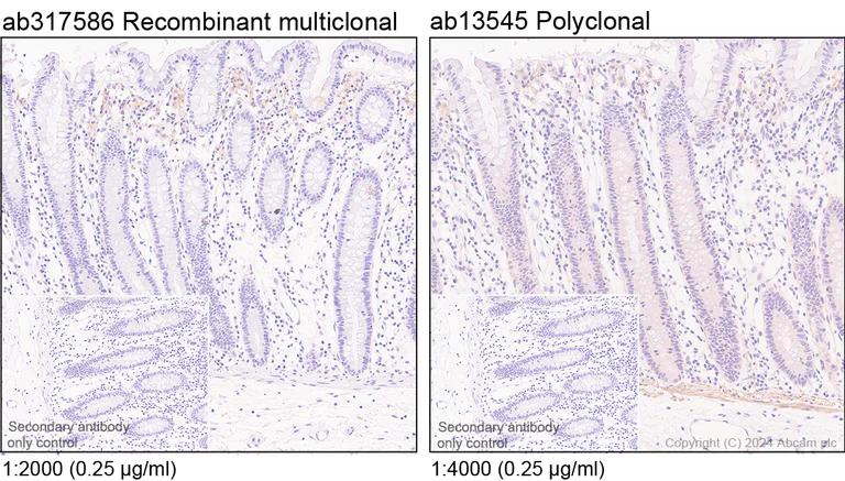 Immunohistochemistry (Formalin/PFA-fixed paraffin-embedded sections) - Anti-CD40 antibody [RM1193] - BSA and Azide free (AB317587)