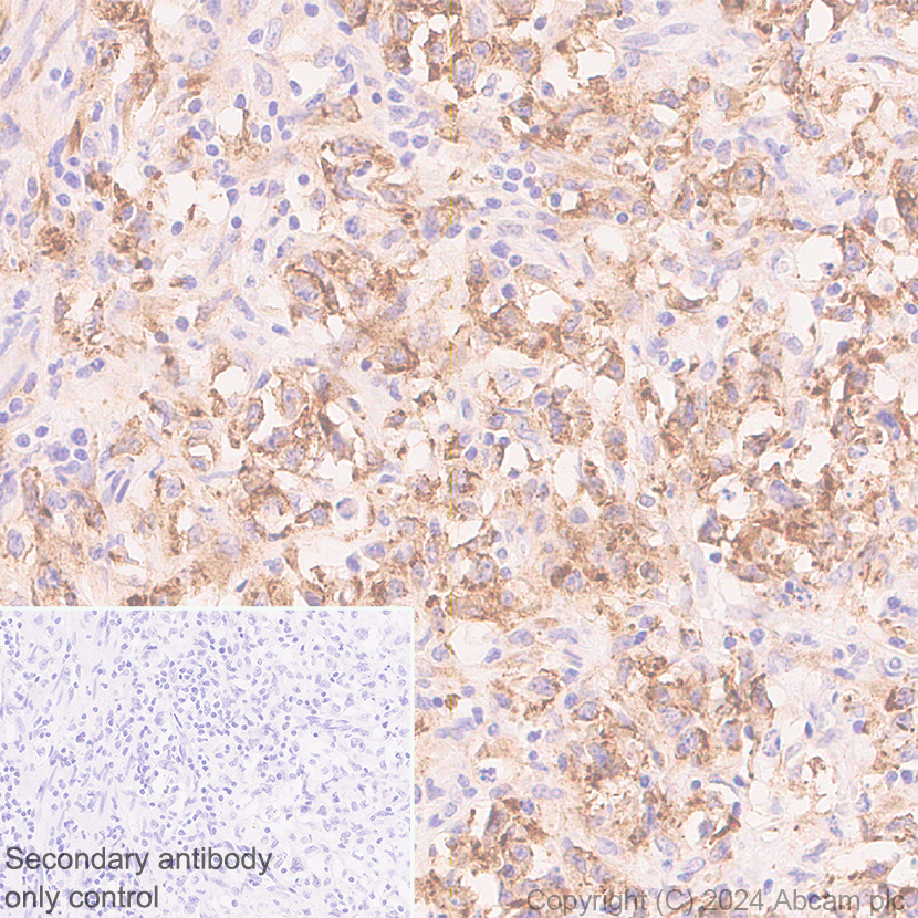 Immunohistochemistry (Formalin/PFA-fixed paraffin-embedded sections) - Anti-CD40 antibody [RM1193] - BSA and Azide free (ab317587), expandable thumbnail