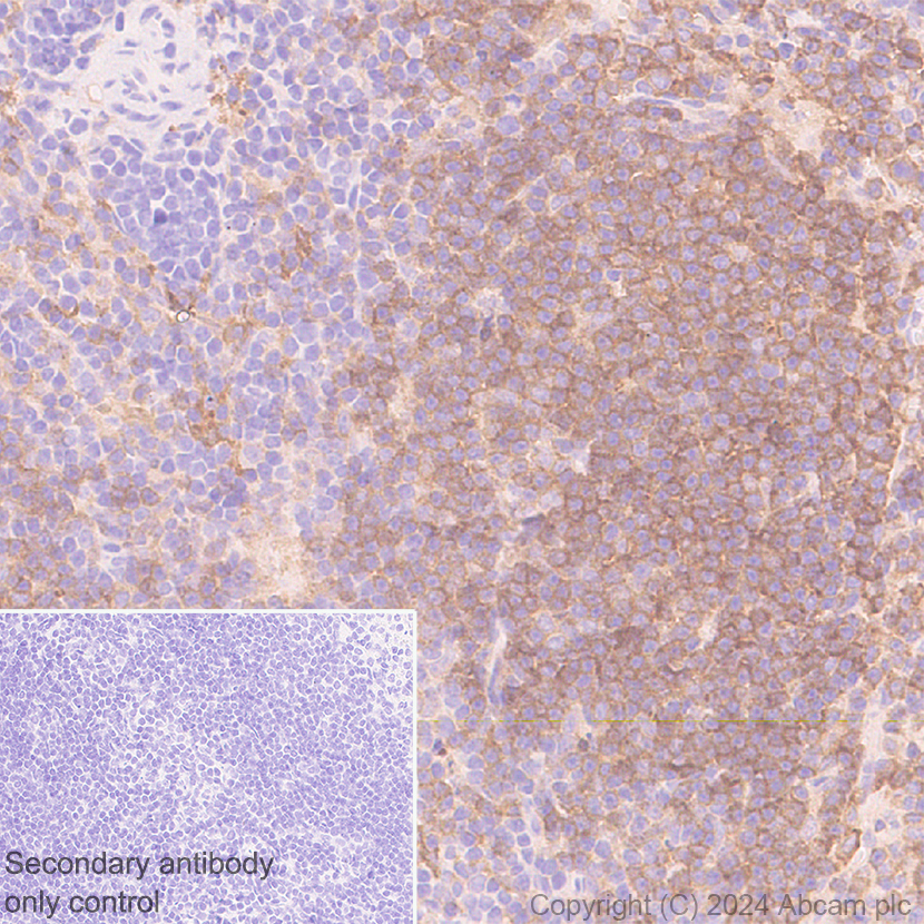 Immunohistochemistry (Formalin/PFA-fixed paraffin-embedded sections) - Anti-CD40 antibody [RM1193] - BSA and Azide free (ab317587), expandable thumbnail