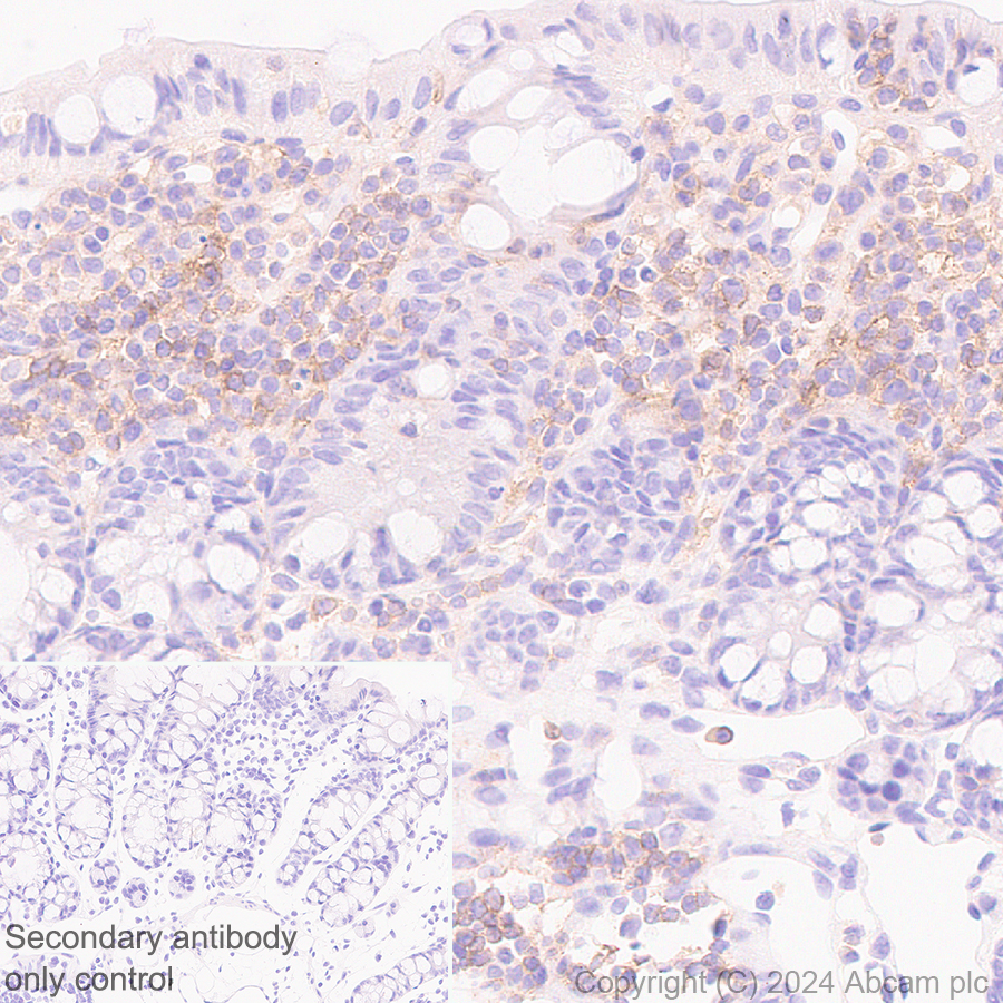 Immunohistochemistry (Formalin/PFA-fixed paraffin-embedded sections) - Anti-CD40 antibody [RM1193] - BSA and Azide free (ab317587), expandable thumbnail