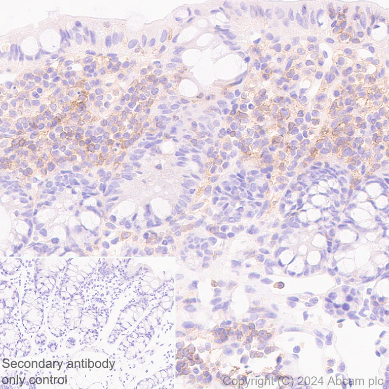 Immunohistochemistry (Formalin/PFA-fixed paraffin-embedded sections) - Anti-CD40 antibody [RM1193] - BSA and Azide free (AB317587)