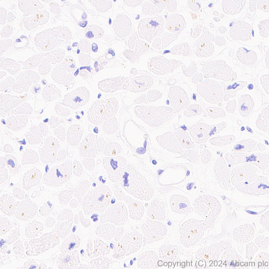 Immunohistochemistry (Formalin/PFA-fixed paraffin-embedded sections) - Anti-CD40 antibody [RM1193] - BSA and Azide free (ab317587), expandable thumbnail