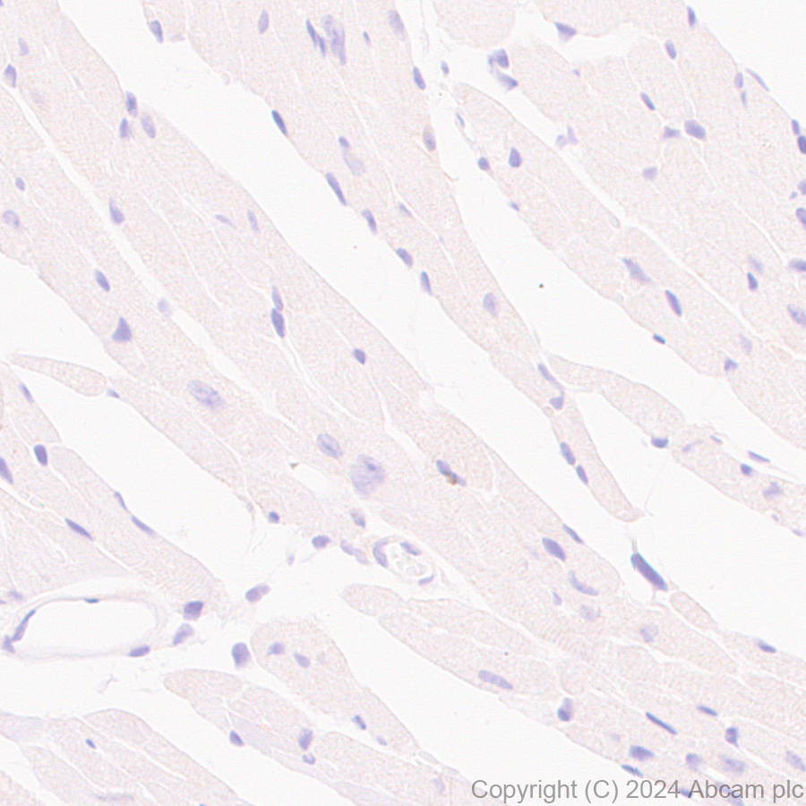 Immunohistochemistry (Formalin/PFA-fixed paraffin-embedded sections) - Anti-CD40 antibody [RM1193] - BSA and Azide free (AB317587), expandable thumbnail