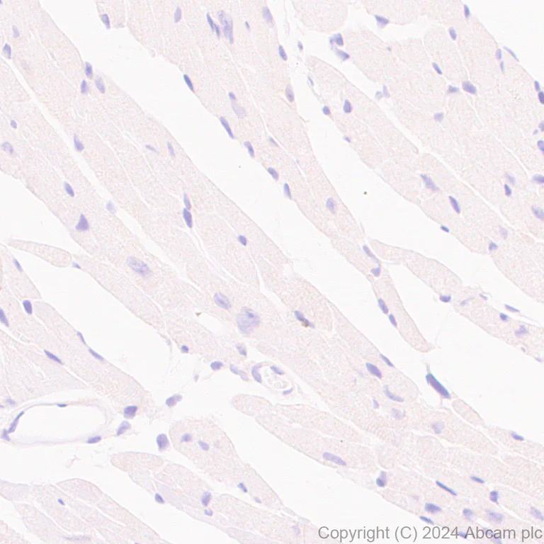 Immunohistochemistry (Formalin/PFA-fixed paraffin-embedded sections) - Anti-CD40 antibody [RM1193] - BSA and Azide free (AB317587)