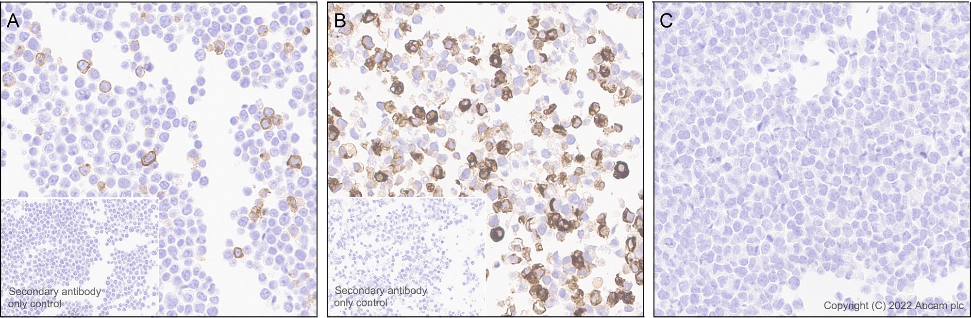Immunohistochemistry (Formalin/PFA-fixed paraffin-embedded sections) - Anti-CD40 Ligand antibody [EPR26530-17] (AB303610)