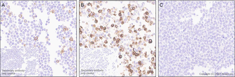 Immunohistochemistry (Formalin/PFA-fixed paraffin-embedded sections) - Anti-CD40 Ligand antibody [EPR26530-17] (AB303610)