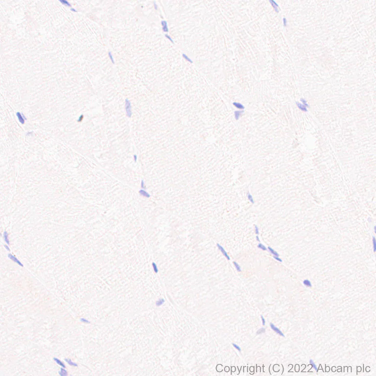 Immunohistochemistry (Formalin/PFA-fixed paraffin-embedded sections) - Anti-CD40 Ligand antibody [EPR26530-17] (AB303610)
