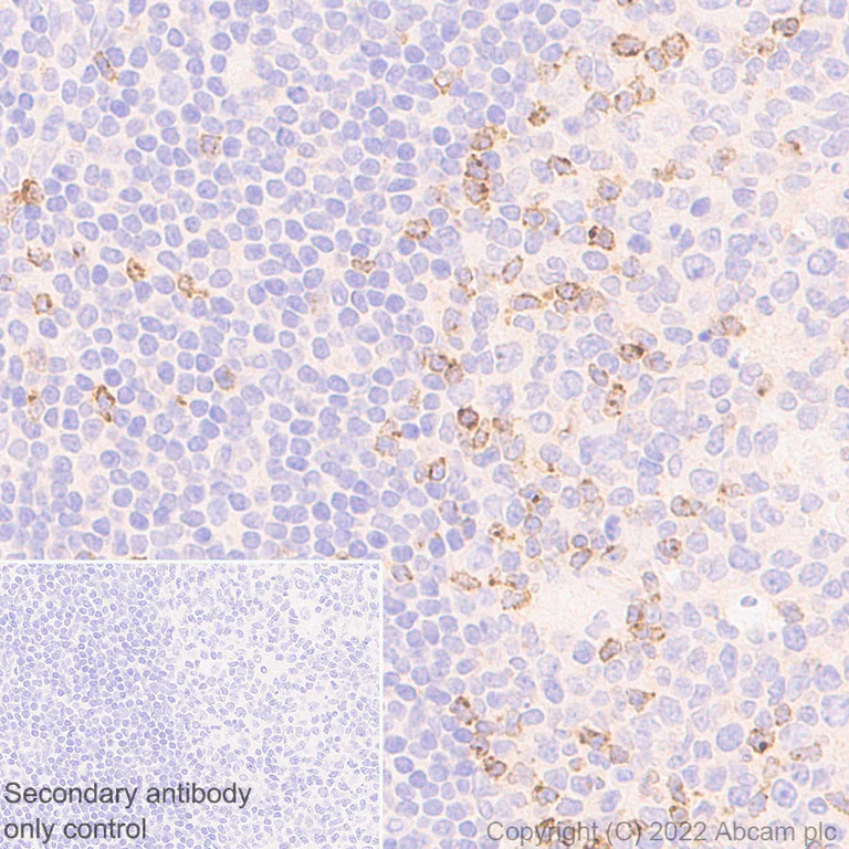 Immunohistochemistry (Formalin/PFA-fixed paraffin-embedded sections) - Anti-CD40 Ligand antibody [EPR26530-17] (AB303610)