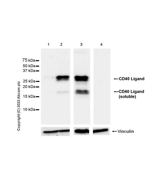 Western blot - Anti-CD40 Ligand antibody [EPR26530-17] (AB303610)