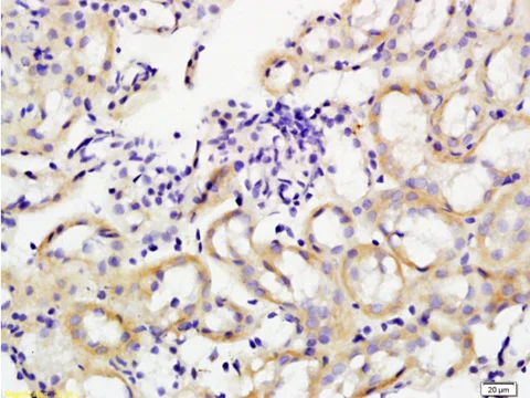 Immunohistochemistry (Formalin/PFA-fixed paraffin-embedded sections) - Anti-CD41 antibody (AB203189)