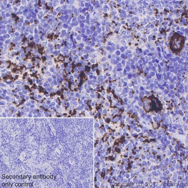 Immunohistochemistry (Formalin/PFA-fixed paraffin-embedded sections) - Anti-CD41 antibody [EPR17876] (AB181582), expandable thumbnail