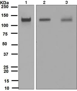 Western blot - Anti-CD41 antibody [EPR4330] (AB134131)