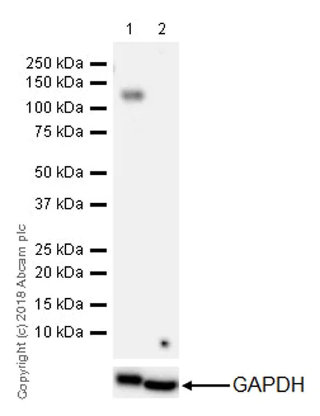 Western blot - Anti-CD41 antibody [EPR4330] (AB134131)