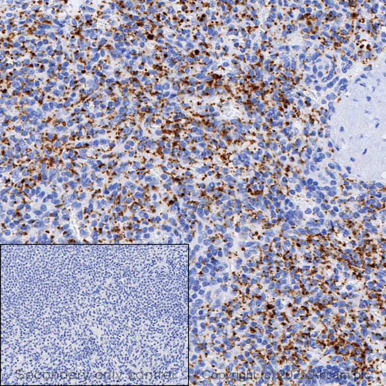 Immunohistochemistry (Formalin/PFA-fixed paraffin-embedded sections) - Anti-CD41 antibody [EPR4330] - Low endotoxin, Azide free (AB229448)