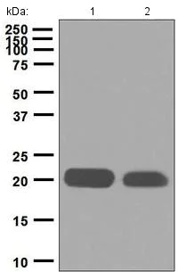 Western blot - Anti-CD42a/GP-IX antibody [EP5294] - BSA and Azide free (AB284806)