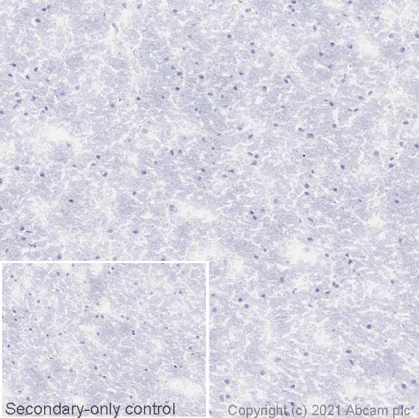 Immunohistochemistry (Frozen sections) - Anti-CD42b antibody [AK2] (AB61402)